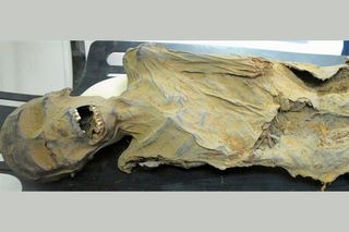 A mummified, woman in her mid-40s who lived in what is now Peru between 1,100 and 1,800 years ago showed signs of narrowed arteries.