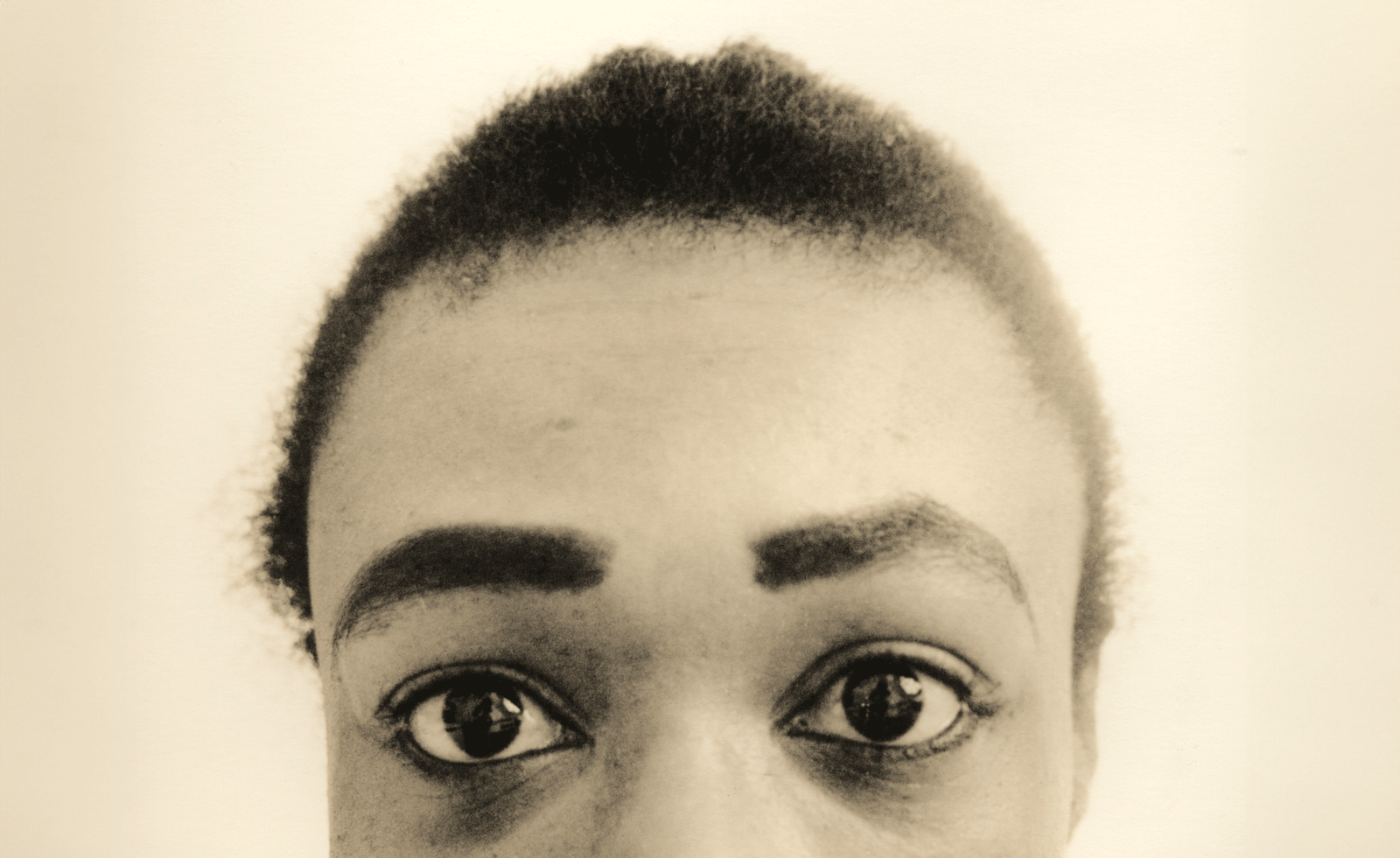 photographs of body parts