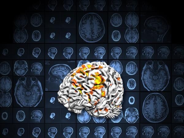 Functional MRI technology