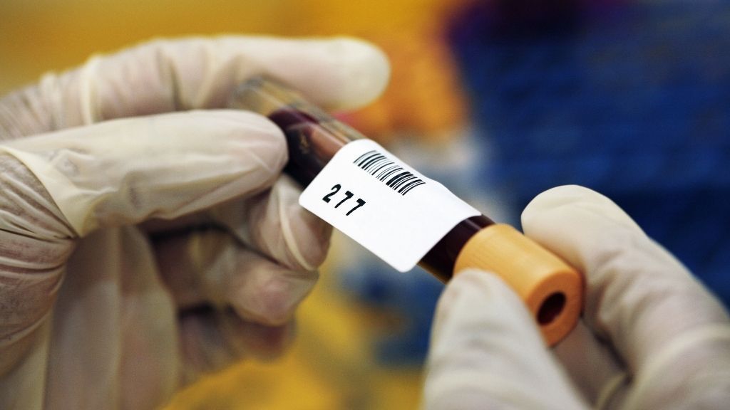 close up of a pathologist&#039;s hands as they label a test tube containing a blood sample