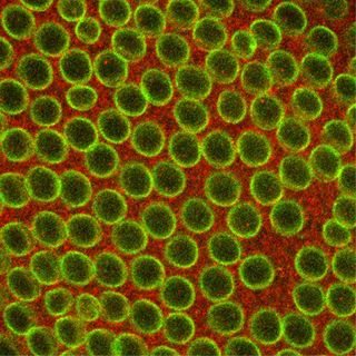 Cells in an early-stage fruit fly embryo that were dyed for research purposes.