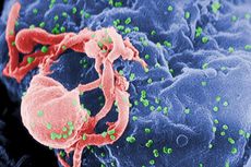 The human immunodeficiency virus (HIV, in green), infecting a cell. Image taken with an electron scanning microscope.