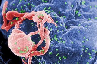 The human immunodeficiency virus (HIV, in green), infecting a cell. Image taken with an electron scanning microscope.