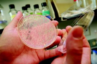 yeast cells in petri dish