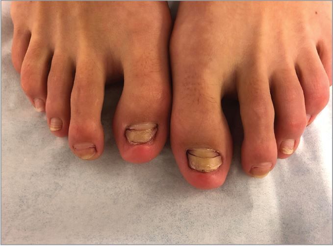 Woman's 'Fish Pedicure' Tied to Odd Toenail Problem Live Science