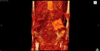 One of the most puzzling things revealed in the CT scans were two thin plaques made of something similar to cartonnage (a plastered material), placed over the female mummy's sternum and abdomen.