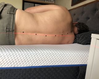 Man lying on bed with points across his back to show spinal alignment