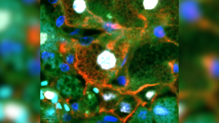 Microscope image in the center with a blurred version of the image layered behind. The image is of the newly-discovered liver repair cells. The nucleus of these cells can be seen in white and the cell membrane in red. There are also diffuse areas of green and blobs of blue dotted throughout the image, both dark blue and cyan