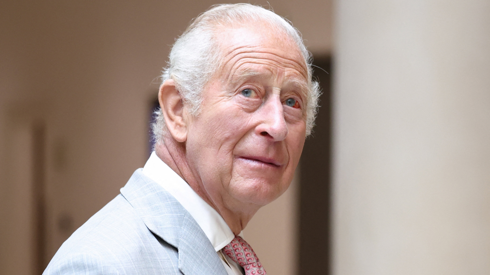 King Charles has white gray hair and one of his eyes is bloodshot with a pink spot and he wears a light gray suit with a tie