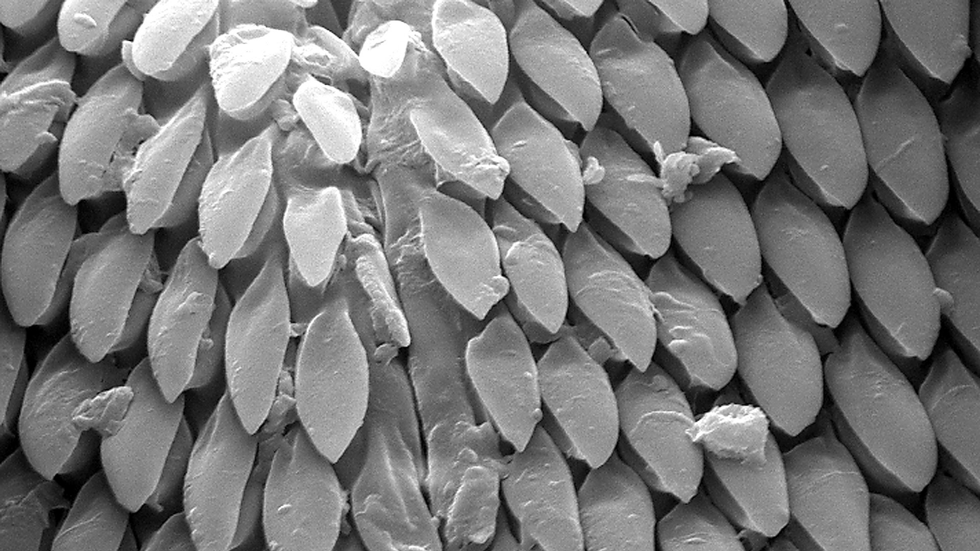 Cette micrographie électronique à balayage (SEM) nous montre une vue agrandie des pièces buccales d'une tique américaine du chien (Dermacentor variabilis) agrandie plus de 3 000 fois.