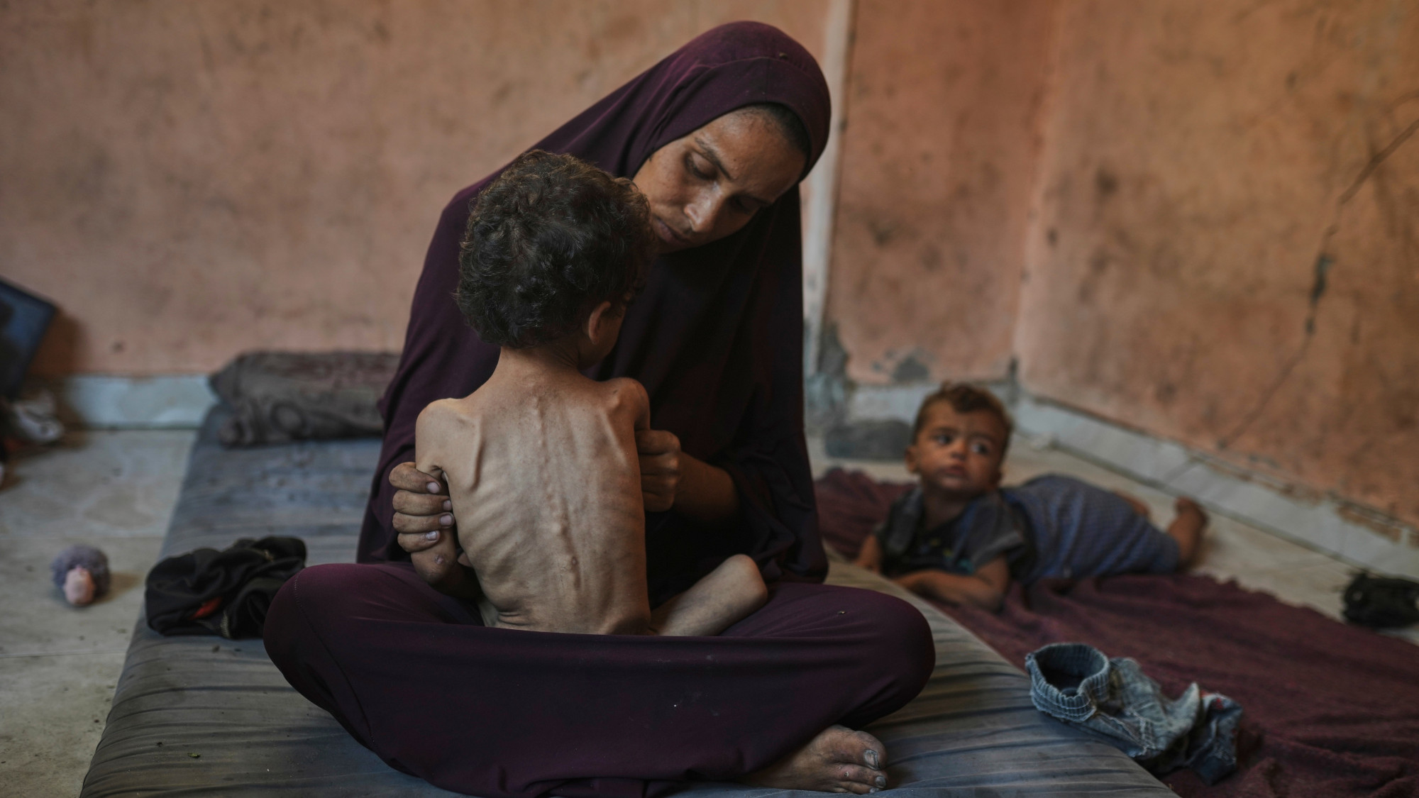 Naima Abu Ful poses for a photo with her 2-year-old malnourished child, Yazan.