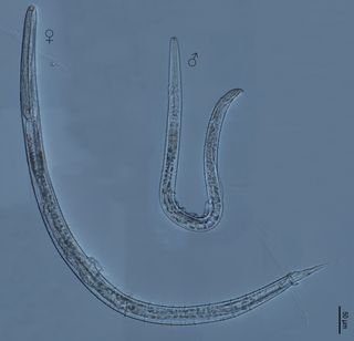 The new nematode Myolaimus ibericus, seen under a light microscope. The worm is unlike other nematodes in that it has two layers of skin and no penis.