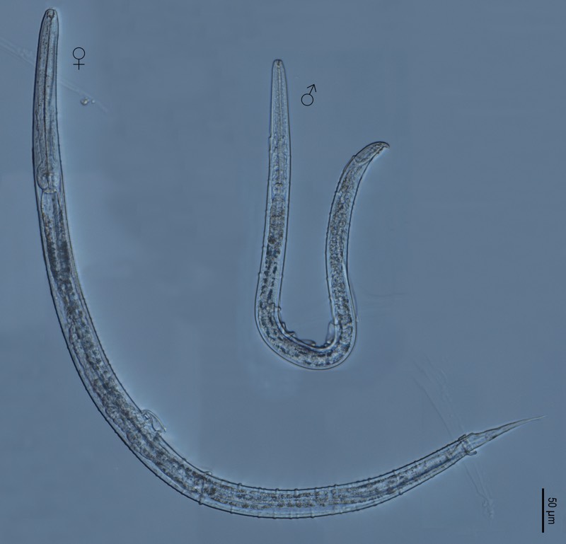 The new nematode Myolaimus ibericus, seen under a light microscope. The worm is unlike other nematodes in that it has two layers of skin and no penis.