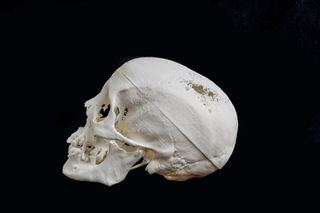 3D-Printed Skull from Egyptian Mummy