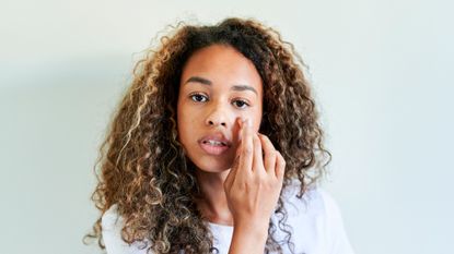 woman with eczema on her face applying cream