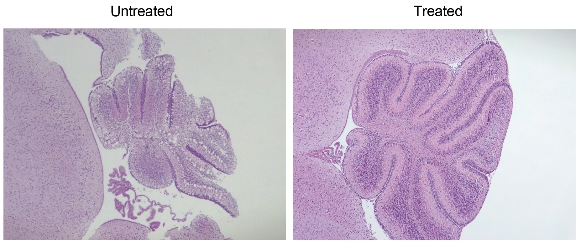 two images of part of a mouse brain are shown side by side. The left image shows marked tissue degradation, whereas the brain looks healthier and more robust on the right