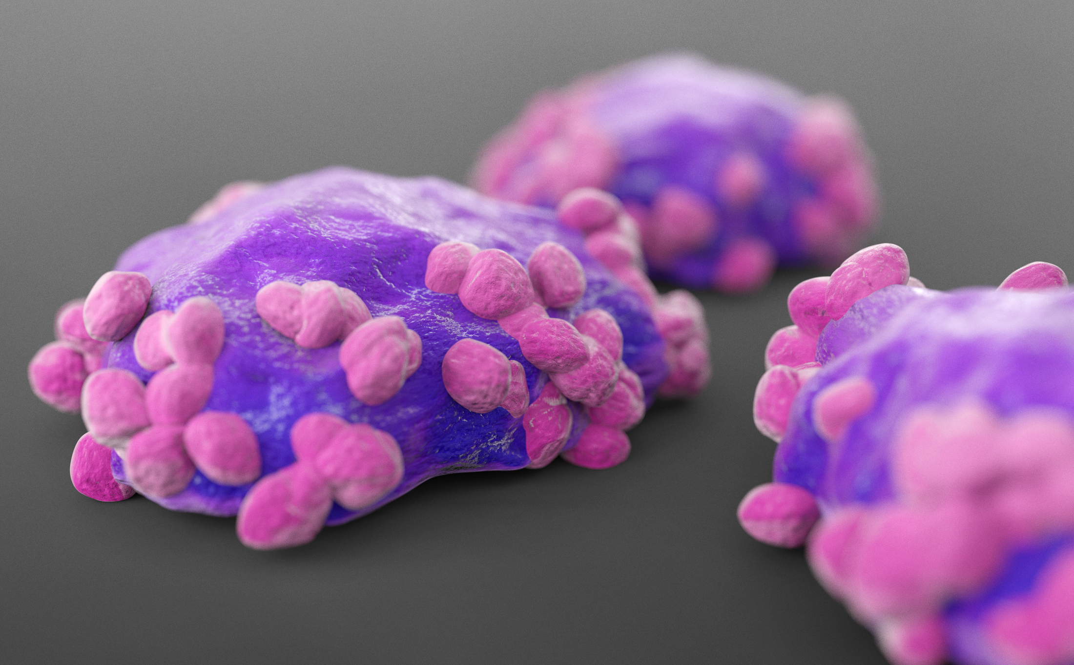 An illustration of lymphoma cells