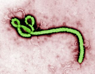 An image of the Ebola virus