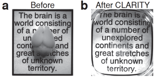 CLARITY transformation of a mouse brain at left into a transparent but still intact brain at right. Shown superimposed over a quote from the great Spanish neuroanatomist Ramon y Cajal.