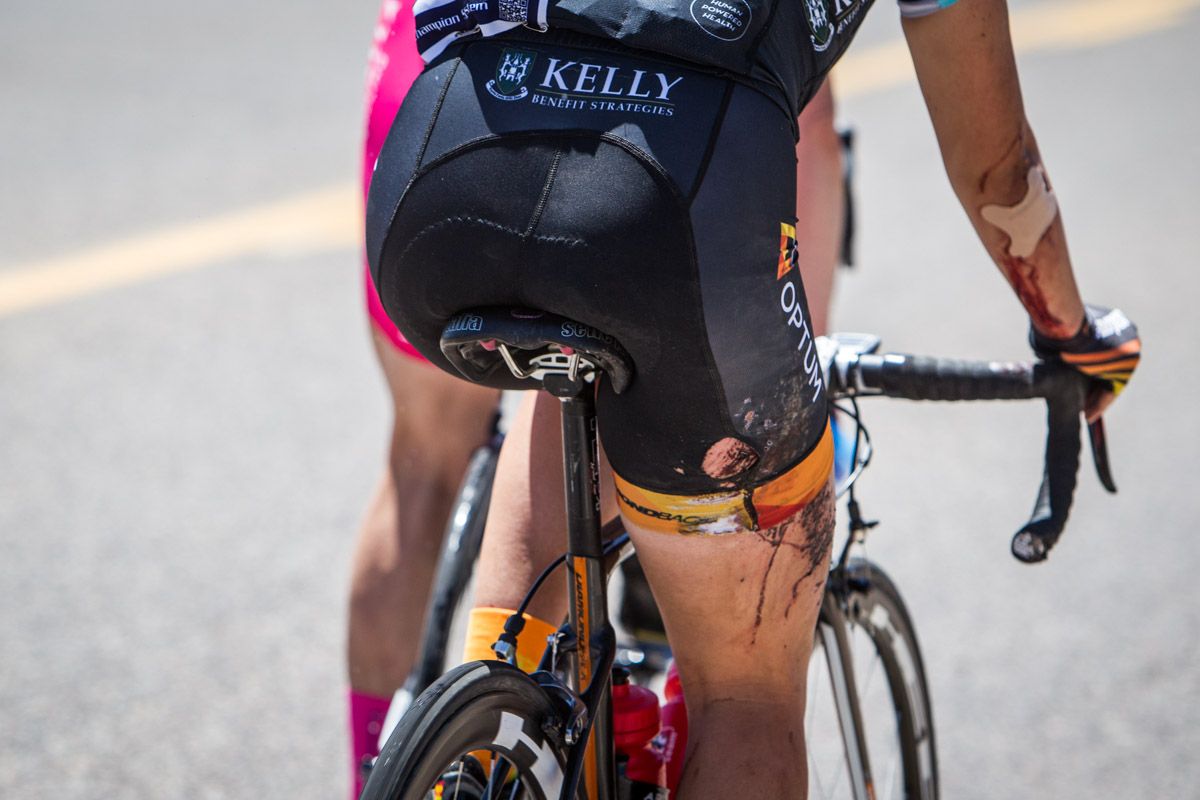 Annie Ewart (Optum) got banged up from a crash before taking todays win