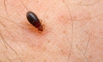 Beneath the visible hairs, the human body has even tinier hairs that help people detect bedbugs crawling on them.