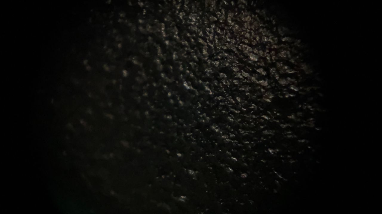 iMicro Q3p fingertip smartphone microscope
