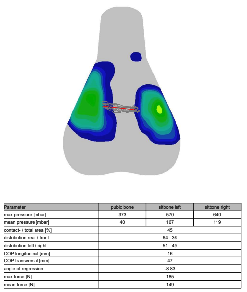 A visual output of saddle pressure mapping