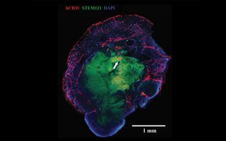 In a "minibrain," blood vessels (red) penetrate the outer layers of the organoid (blue), with some growth into the organoid core (green).