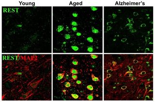 rest protein neurons