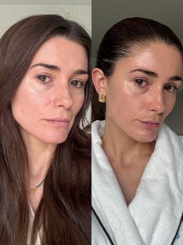 Shark CryoGlow LED Face Mask, Honestly Reviewed | Who What Wear