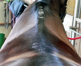 Sore back
