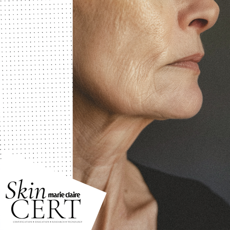 Skincert: Inflammaging