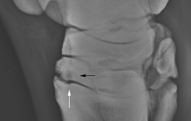 OA hock_220705551_305705321