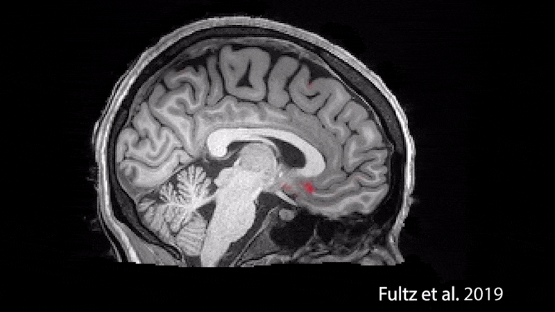 During sleep, waves of oxygenated blood (red) and then cerebrospinal fluid (blue) wash over the brain.