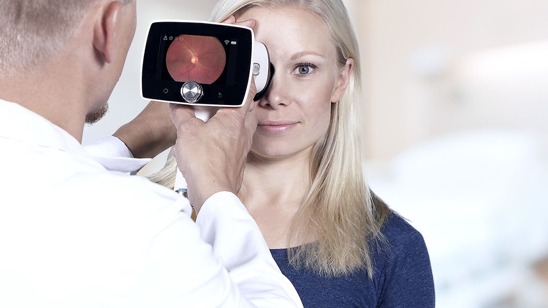 Optomed Aurora fundus camera