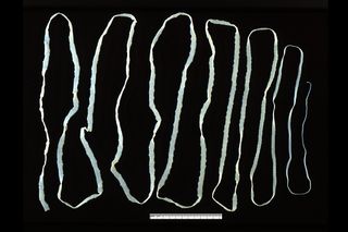 An adult Taenia saginata, the beef tapeworm. The ruler at the bottom is about 11.5 centimeters (4.5 inches) long.