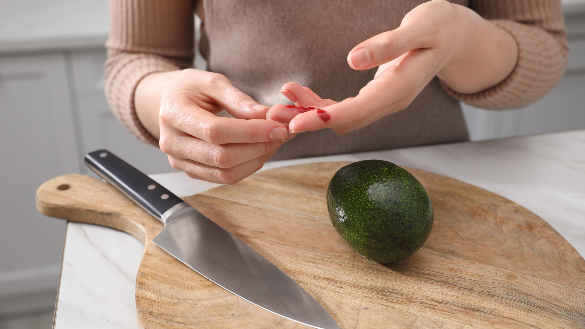 Fotografia de uma mão com um pequeno corte ao lado de uma faca e uma tábua de cortar.