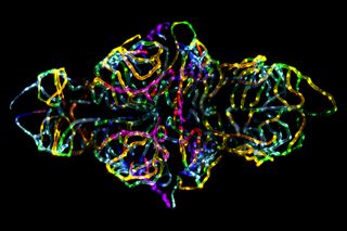 First place went to this photo showing the blood-brain barrier in a live zebrafish embryo.