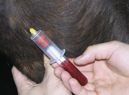 Blood test