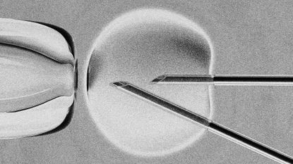 Photo collage of an in vitro fertilisation. There is a secondary needle, interposing itself between the correct needle and the pipette.