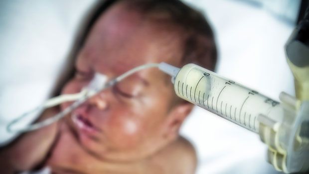 A premature baby receives treatment