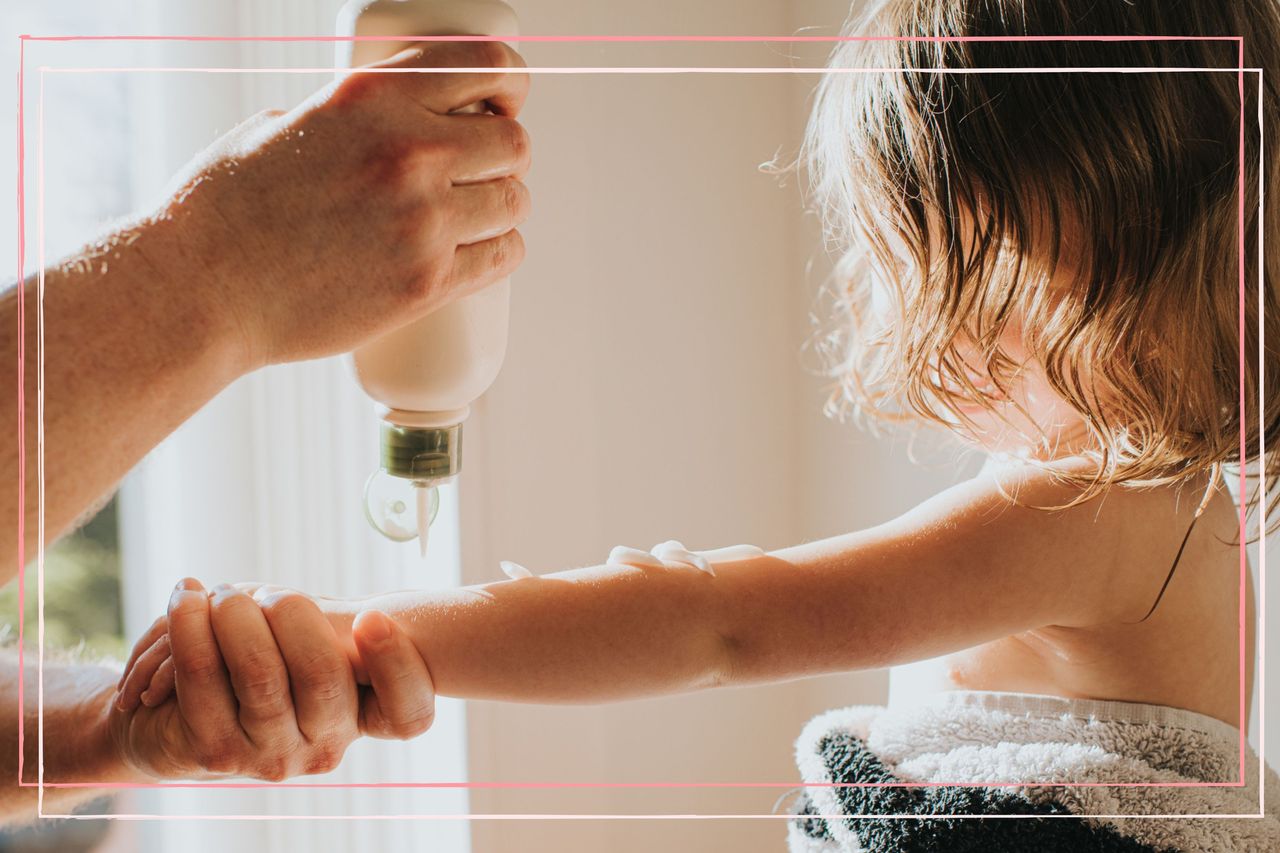 A father applying moisturiser to his child&#039;s arm to keep the skin hydrated - one of the ways to manage psoriasis in children at home