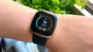 Fitbit versa on sale 2024 today