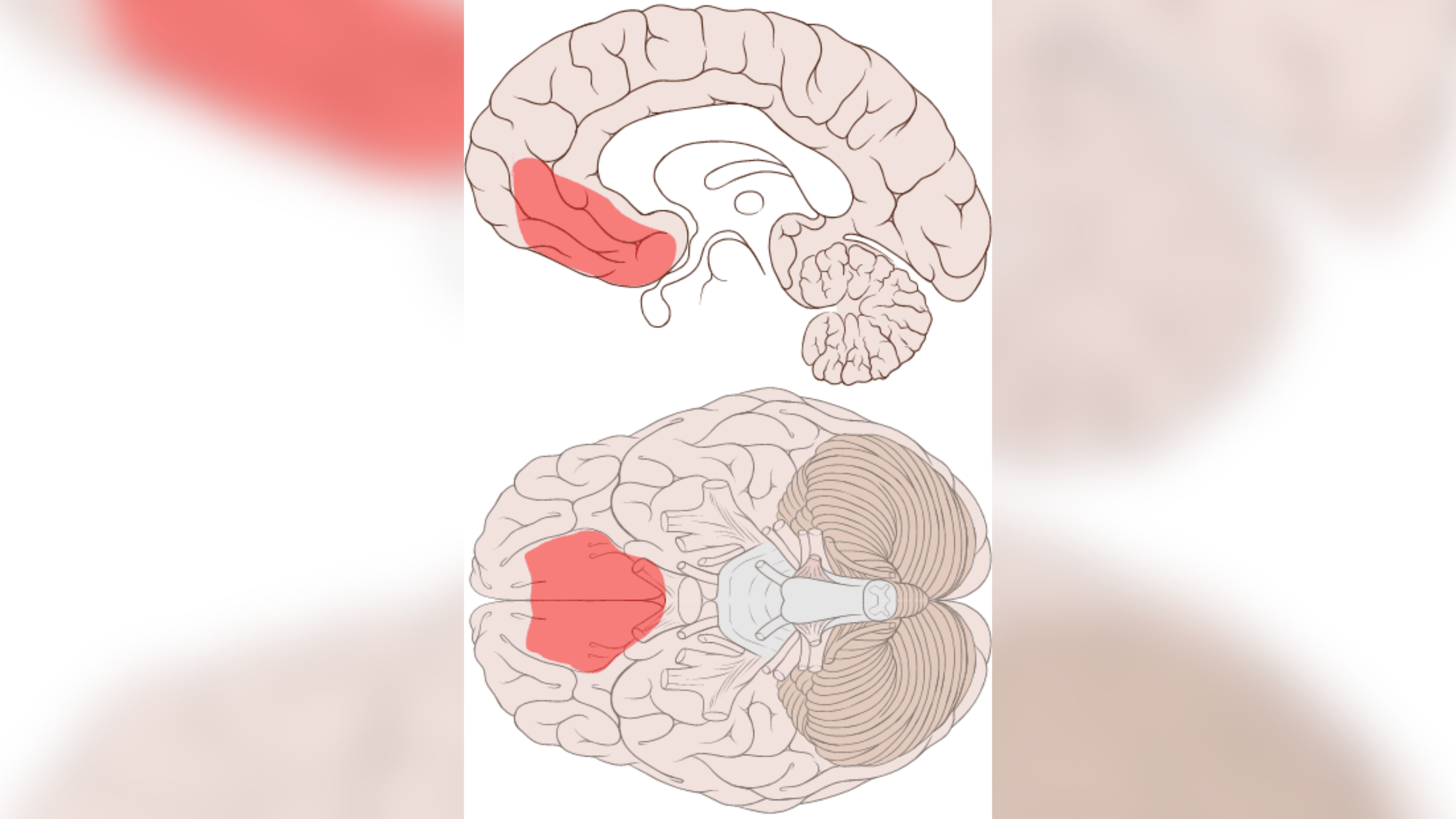 Medical illustration of the brain in black and white highlighting the location of the ventromedial prefrontal cortex in red