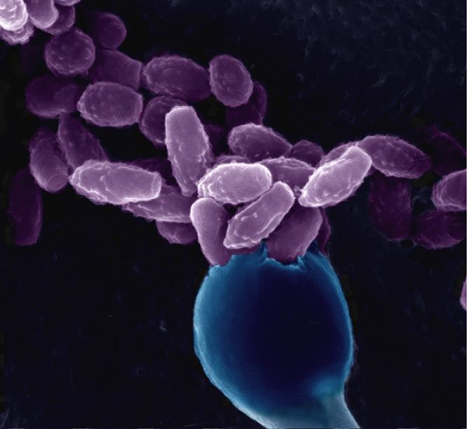 Cryptococcus neoformans yeast