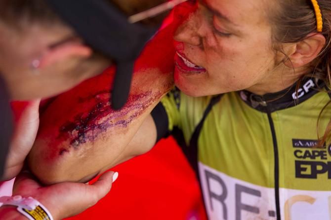 Leading mixed Ariane Kleinhans gets a wound attended to by Team RE:CM manager Kandice Buys