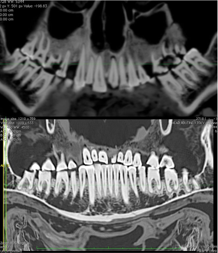 Mummy with Mouthful of Cavities Discovered Live Science