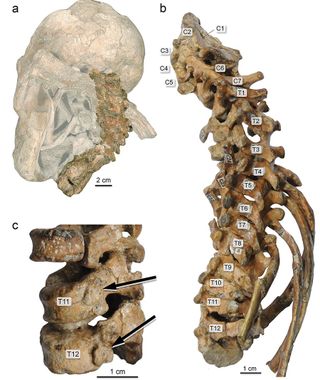 The 3 million-year-old spine of Selam, an <em>Australopithecus afarensis</em> who died at the age of 2 or 3 in what is now Ethiopia.