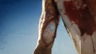 Gross arm is... gross. Very gross.