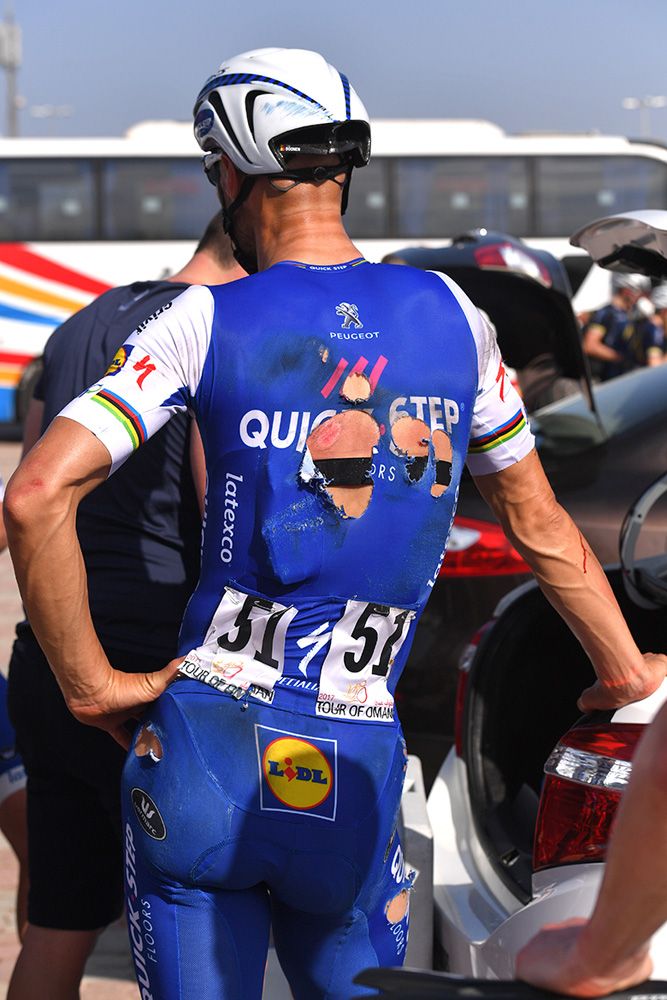 Tom Boonen after his crash in the finale of stage one of the Tour of Oman